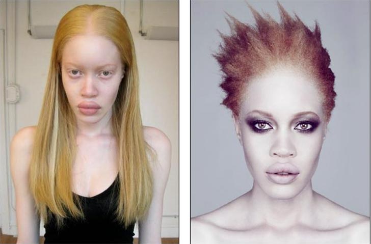 albino african american model